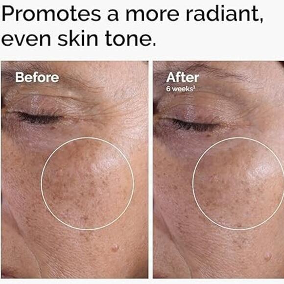 Glycolic Acid 7% Toning Resurfacing Exfoliating Solution BIG SIZE 8oz SEALED - Picture 6 of 7